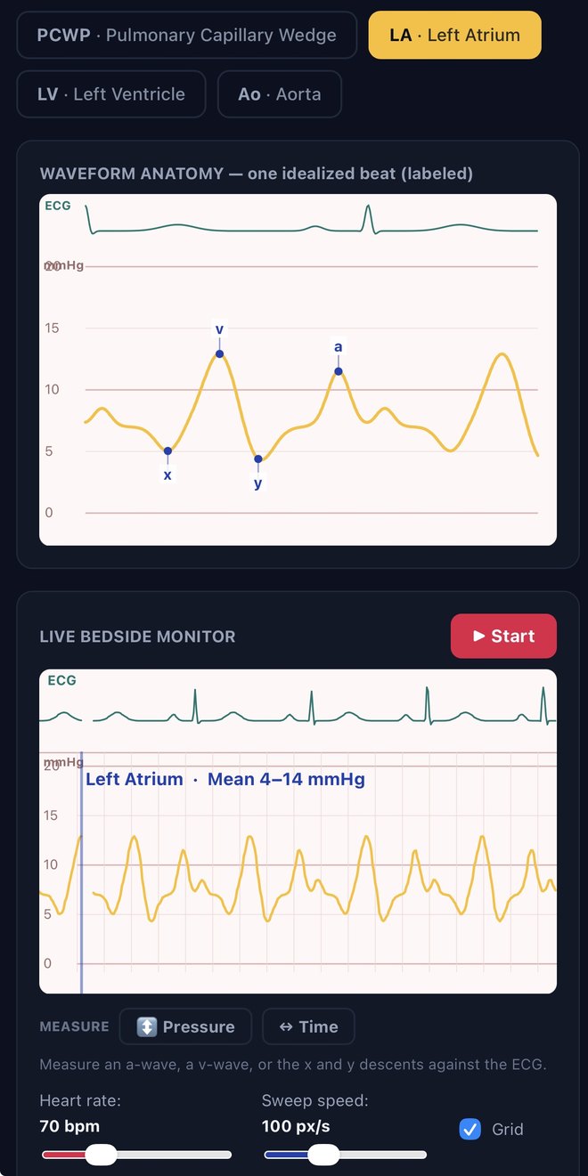 The hemodynamics simulator showing a labeled left-atrial pressure waveform — a wave, v wave, and x and y descents — above a live ECG